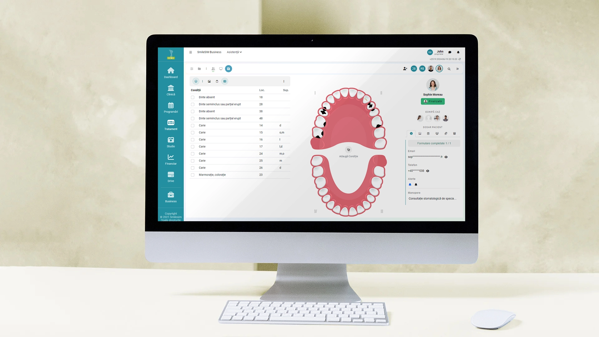Vista previa de la característica de la aplicación de software del módulo del Plan de tratamiento